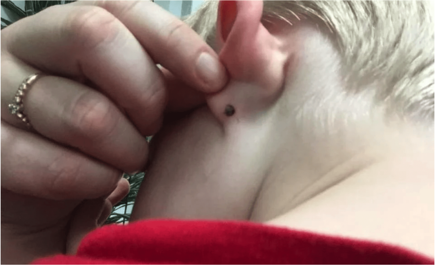 When doctors and parents took him to the emergency hospital, they were startled by what they discovered behind his ear.