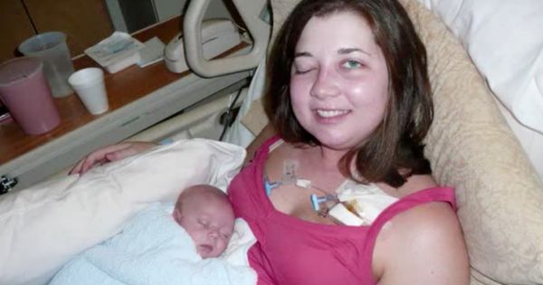 Mom’s right eye stops working after birth – then the doctor sees the unthinkable on radiograph