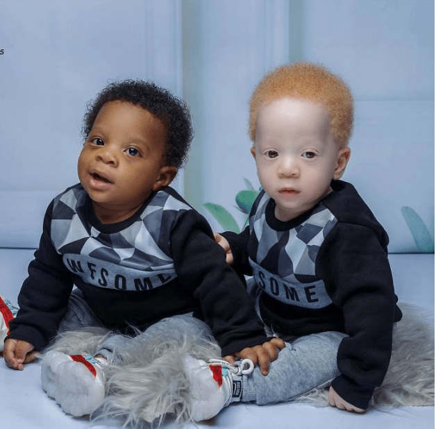 The Extraordinary Journey of Stacy’s Twin Boys