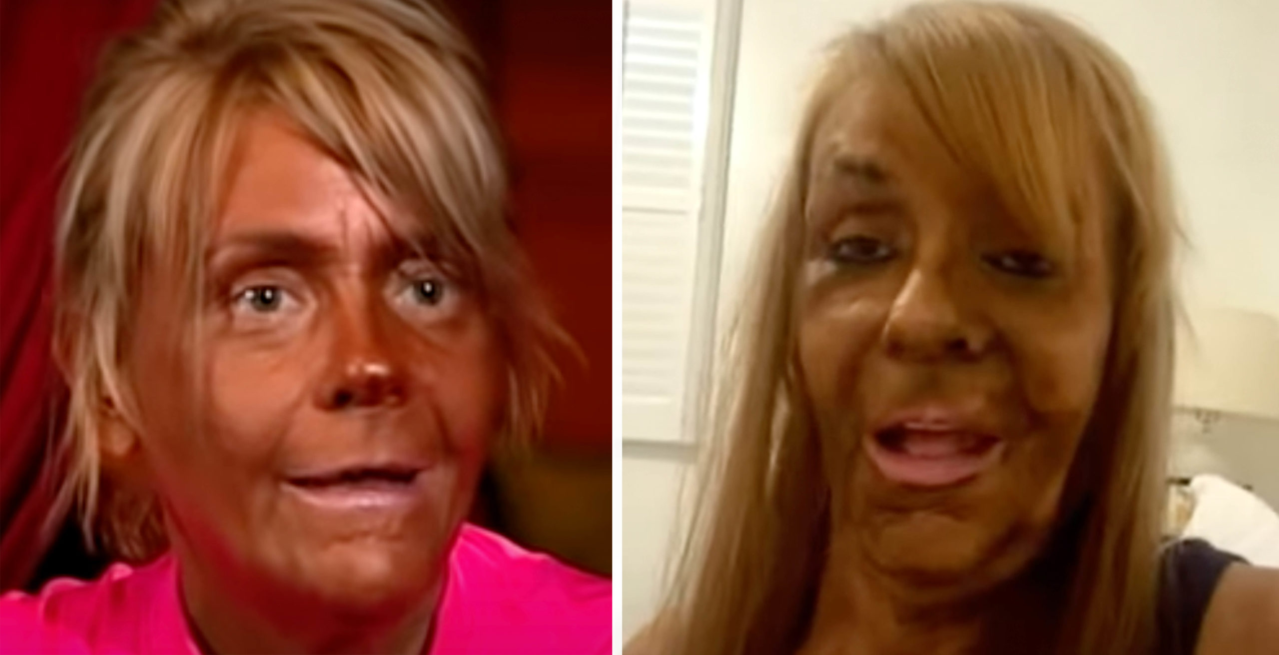 The Dangers of Excessive Tanning