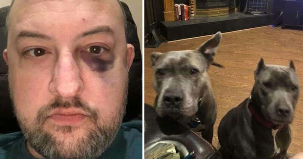 Man adopts unwanted pit bulls, later they save his life