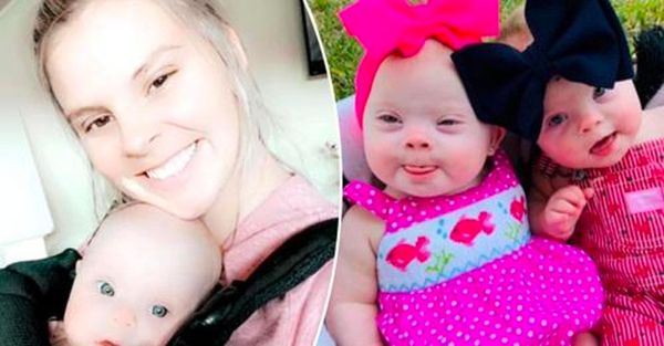 Celebrating the Beauty of Rare Twins with Down Syndrome