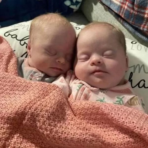 Mom of rare twins with Down syndrome emphasizes their beauty and shuts down critics