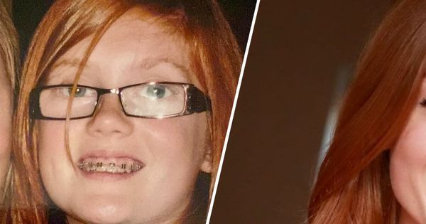 This young girl was spat on because of her red hair – how she looks today makes the bullies sweat with anxiety