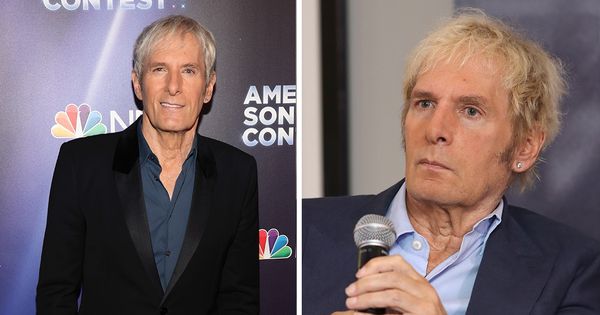 Michael Bolton Recovers After Brain Tumor Surgery