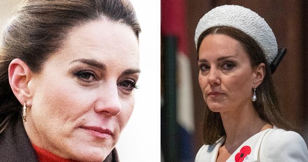 Kate Middleton’s Secret Surgery: A Royal Mystery Unveiled ...