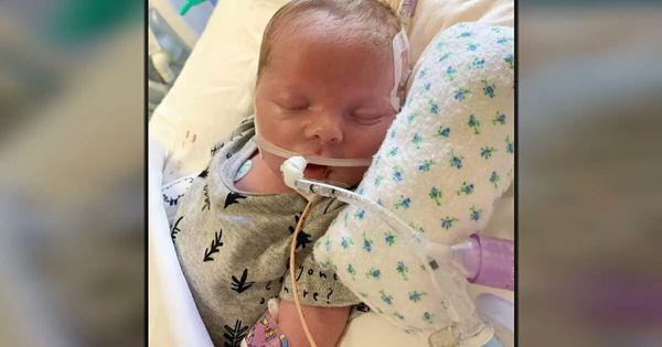 Doctors remove life support and family says farewell to newborn, then he starts breathing