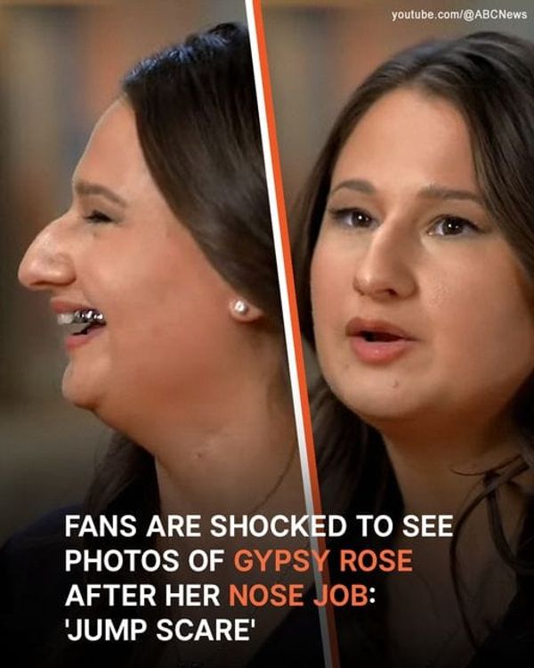 Gypsy Rose Blanchard Makes Public Appearance After Nose Job