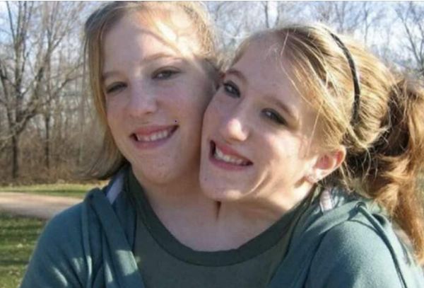 Abby and Brittany: Conjoined Twins Celebrate a Special Wedding