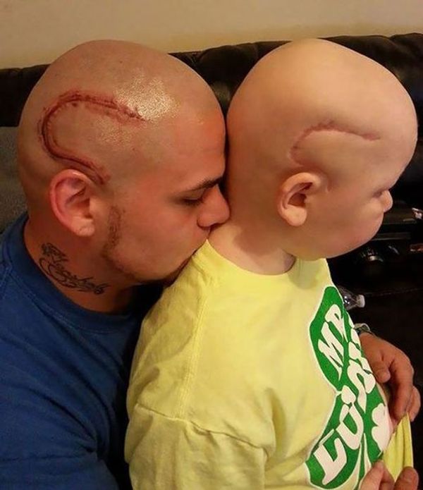 Dad Gets Tattooed So His Son With Cancer Won’t Feel Alone