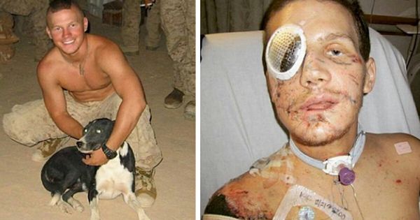 A True American Hero: Kyle Carpenter