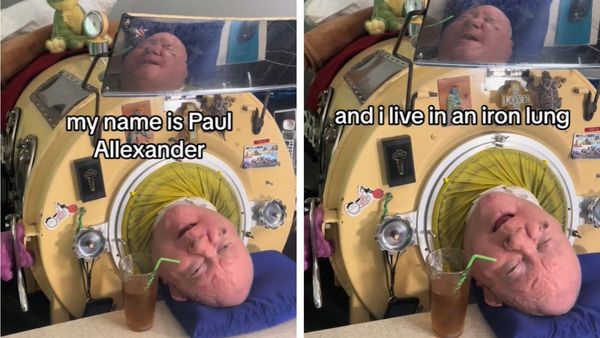 Paul Alexander: A True Inspiration