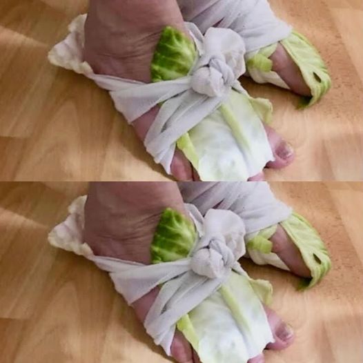 Cabbage Wraps: A Simple Remedy for Swollen Joints and Thyroid Issues