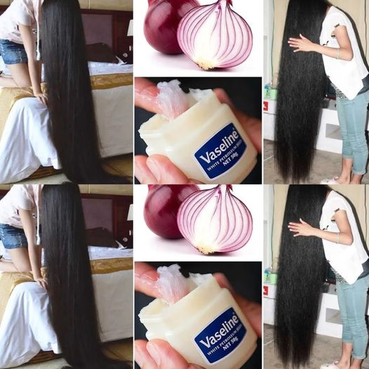 Boost Your Hair Growth with Vaseline and Onion: A Simple Home Remedy