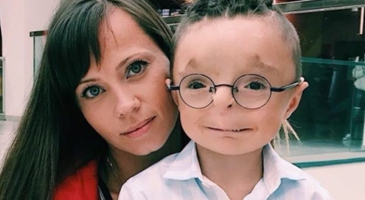 Kind-hearted Woman Adopted a Boy No One Wanted: See What He Looks Like Now