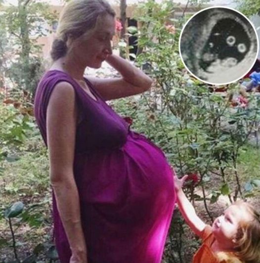 A Historic Pregnancy Surprises Everyone in the Delivery Room: The Tale of Oksana Kobletskaya