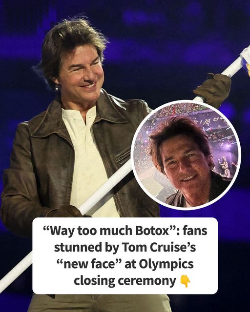 Tom Cruise Gives Amazing Olympic Performance But People Keep Talking About His ‘Puffy Face’