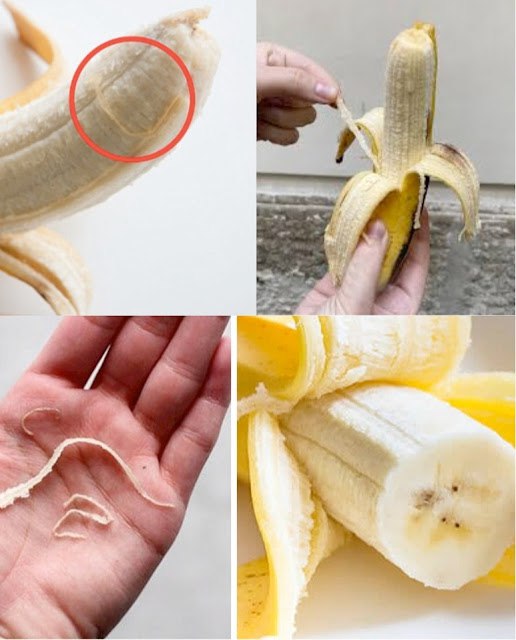 Phloem Bundles: The Secret Strings You Never Knew You Needed on Your Banana