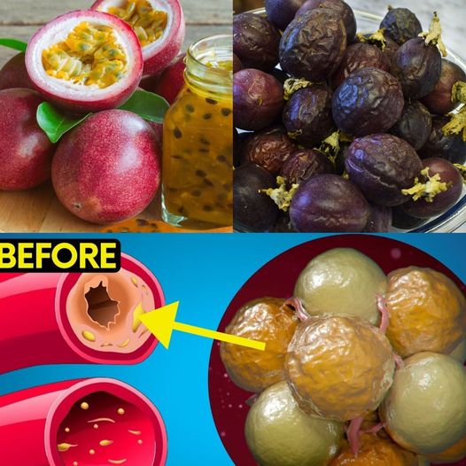 Drinks to Lower Bad Cholesterol Naturally & Reduce Clogged Arteries and Stroke: Passion Fruit Beverage