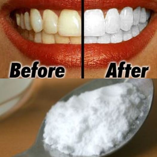 How I Whiten My Teeth At Home