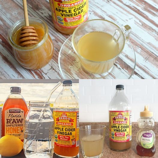 Benefits of Apple Cider Vinegar and Honey