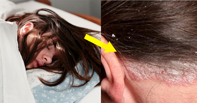 Reasons why you shouldn’t go to sleep with wet hair. No.4 is the most serious