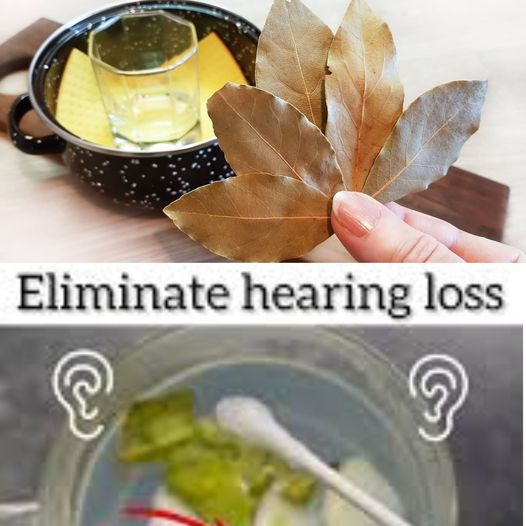 Using Bay Leaves with a Q-Tip to Alleviate Ringing and Noise in the Ears