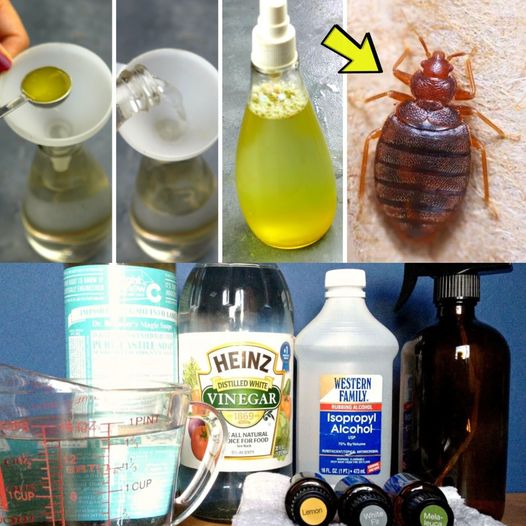 Homemade Bed Bug Spray: Dish Soap, Vinegar, and Rubbing Alcohol