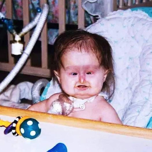 Baby Born With Unusual Syndrome