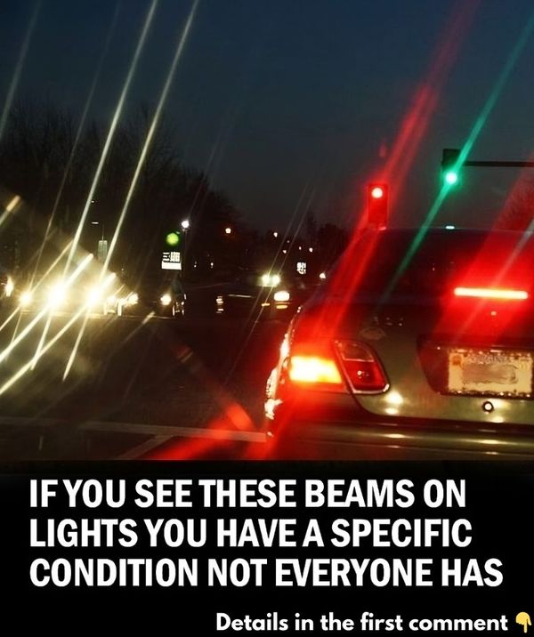 If you see these beams on lights you have a specific condition not everyone has